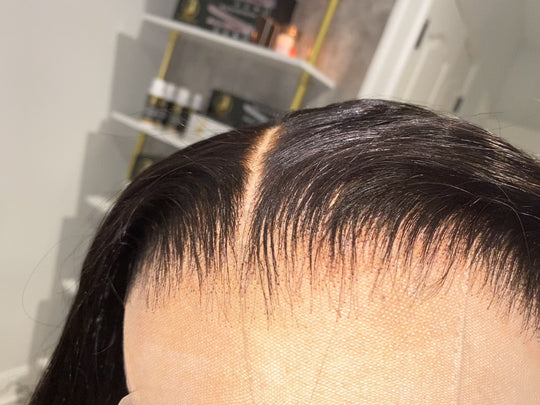 Custom:Plucked Hairline